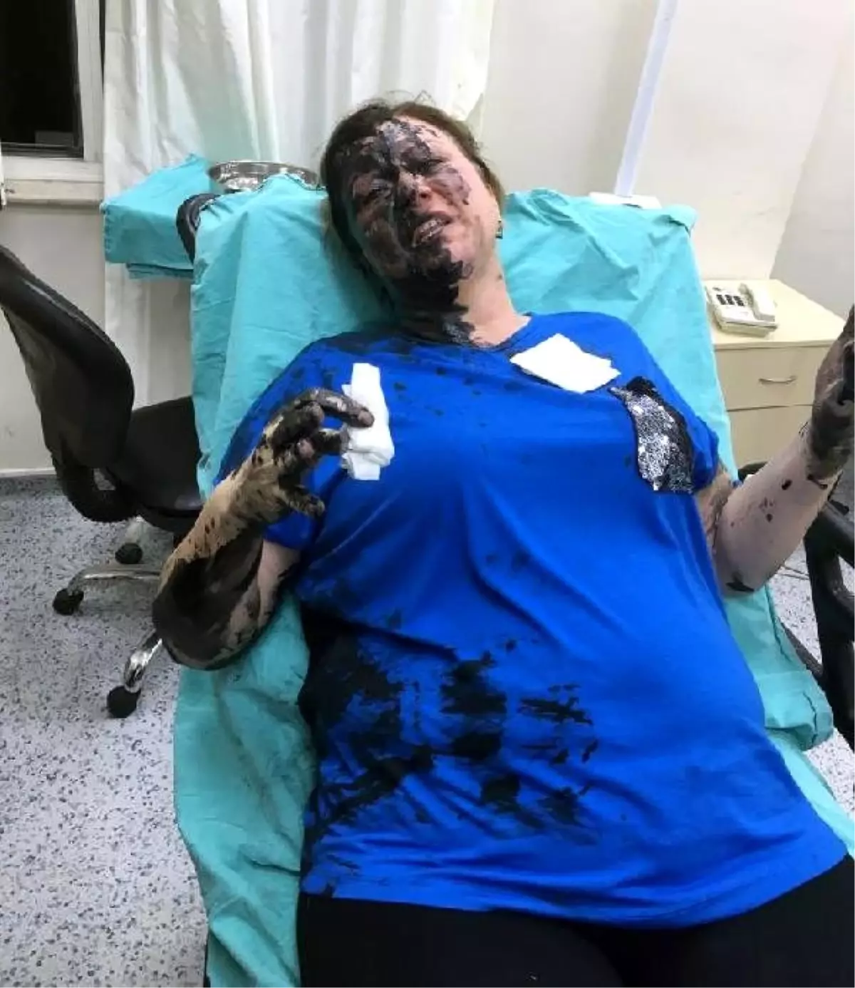 Adana'da iki kişi bir kadını darp edip, üzerine siyah renkli yanıcı madde döktü