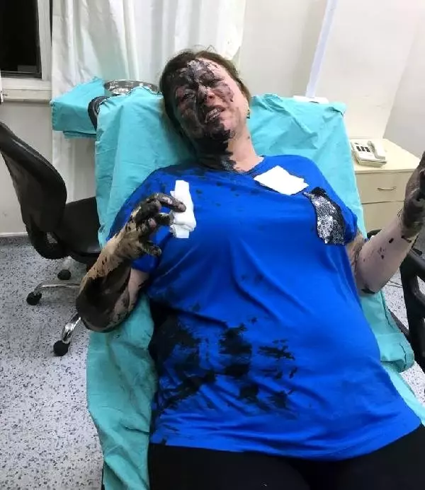 İş kadınını dövüp, üzerine siyah sıvı döktükleri iddiasıyla gözaltına alınanlar serbest