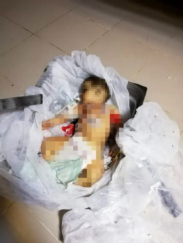 9 aylık Muhammed bebek YPG/PKK�nın kurbanı oldu haberi