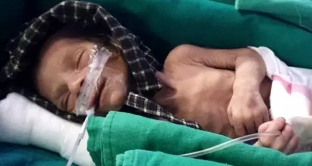 Hindistan'da canlı halde gömülmüş kız bebek bulundu
