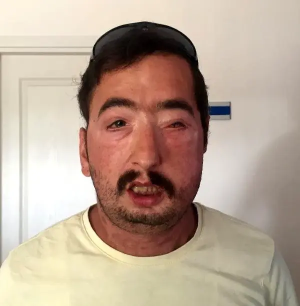 Yeni yüzleriyle tıp tarihine geçip, umut oldular Yeni yüzleriyle tıp tarihine geçip, umut oldular