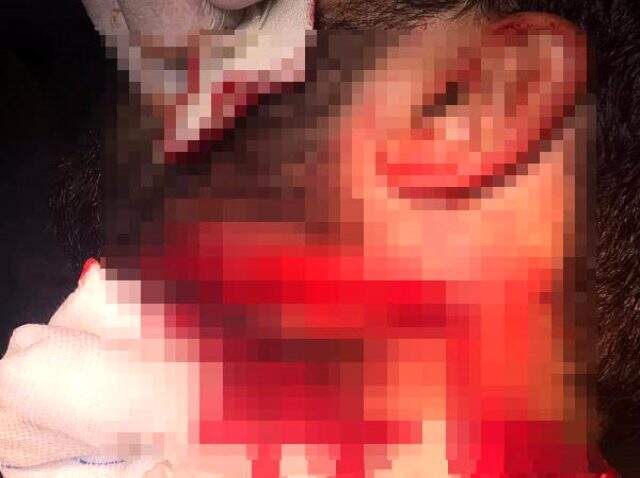 Asistan doktor, hastası tarafından jiletle boğazından yaraladı