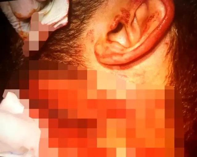 Doktoru boğazından jiletle yaralayan zanlı tutuklandı Doktoru boğazından jiletle yaralayan zanlı tutuklandı