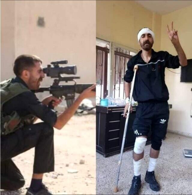 Dürbün kapağını açmadan ateş eden teröristin son hali görüntülendi