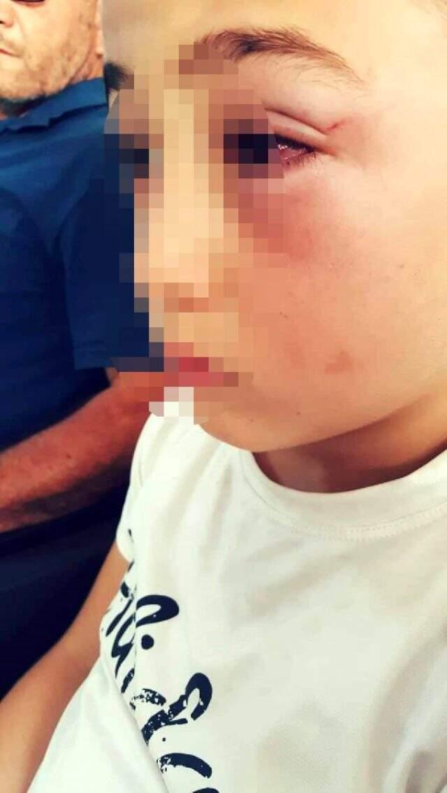 Öfkeli baba, çocuğuyla tartışan okul arkadaşını evine çağırıp yumrukla döverek hastanelik etti