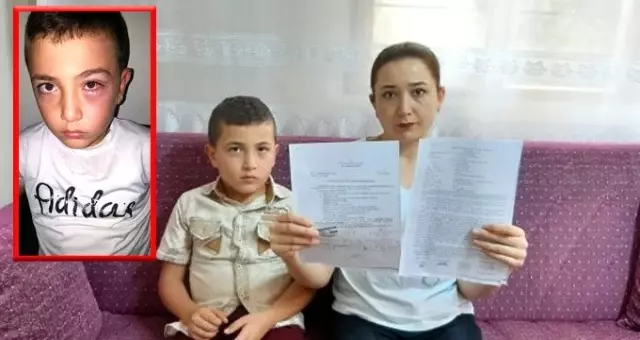 Öfkeli baba, oğlunun tartıştığı 9 yaşındaki çocuğu eve çağırıp yumrukla dövdü