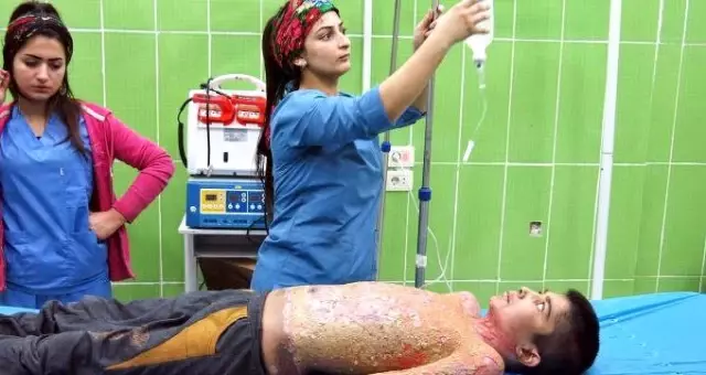 Terör örgütünün 'kimyasal silah' yalanı ortaya çıktı! Kazan ve tişörtü alev almış Terör örgütünün 'kimyasal silah' yalanı ortaya çıktı! Kazan ve tişörtü alev almış