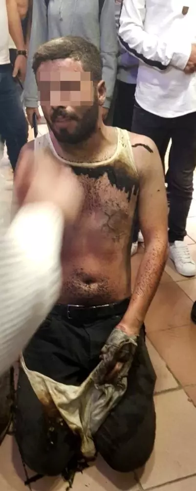 Sokak ortasında eşiyle tartışan adam, benzin dökerek kendini ateşe verdi Sokak ortasında eşiyle tartışan adam, benzin dökerek kendini ateşe verdi