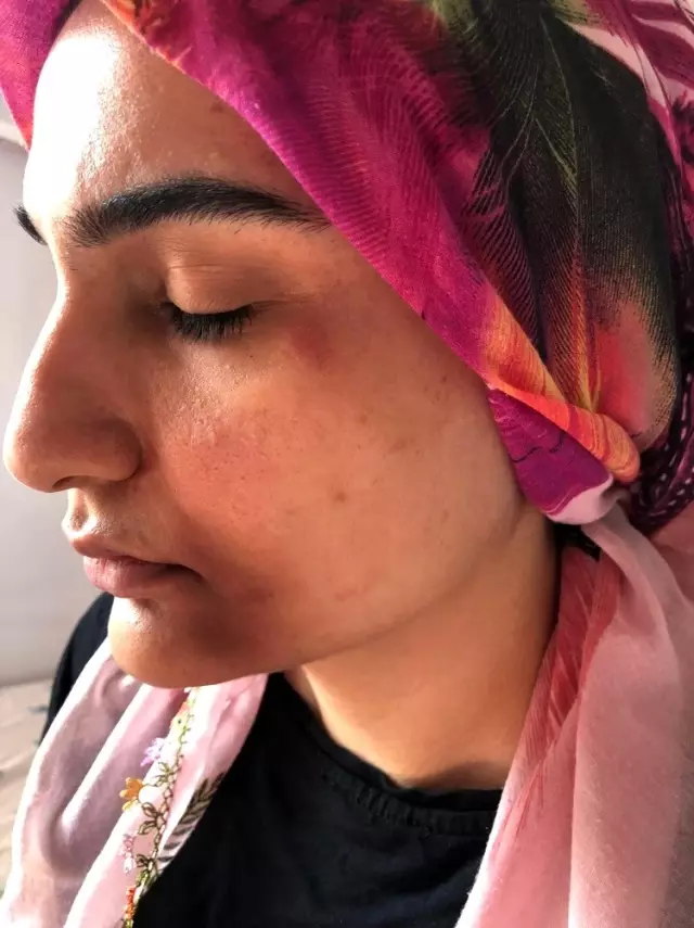 Kızı, kayınpederi tarafından darp edilen baba isyan etti Kızı, kayınpederi tarafından darp edilen baba isyan etti