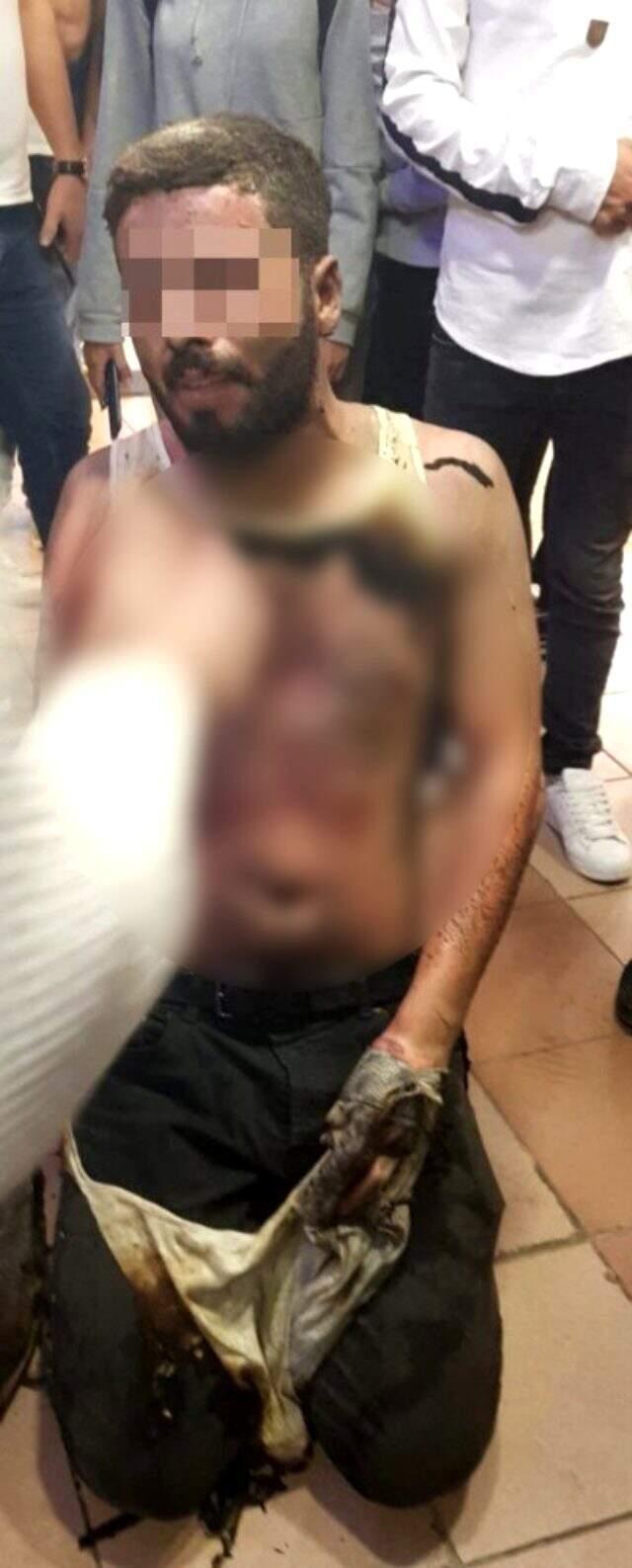 Sokak ortasında eşiyle tartışan adam, benzin dökerek kendini ateşe verdi