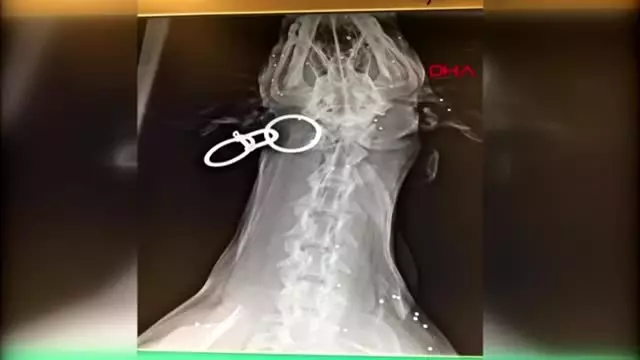 Antalya bahçesine giren köpeği tüfekle vurdu, röntgen filmi şok etti Antalya bahçesine giren köpeği tüfekle vurdu, röntgen filmi şok etti