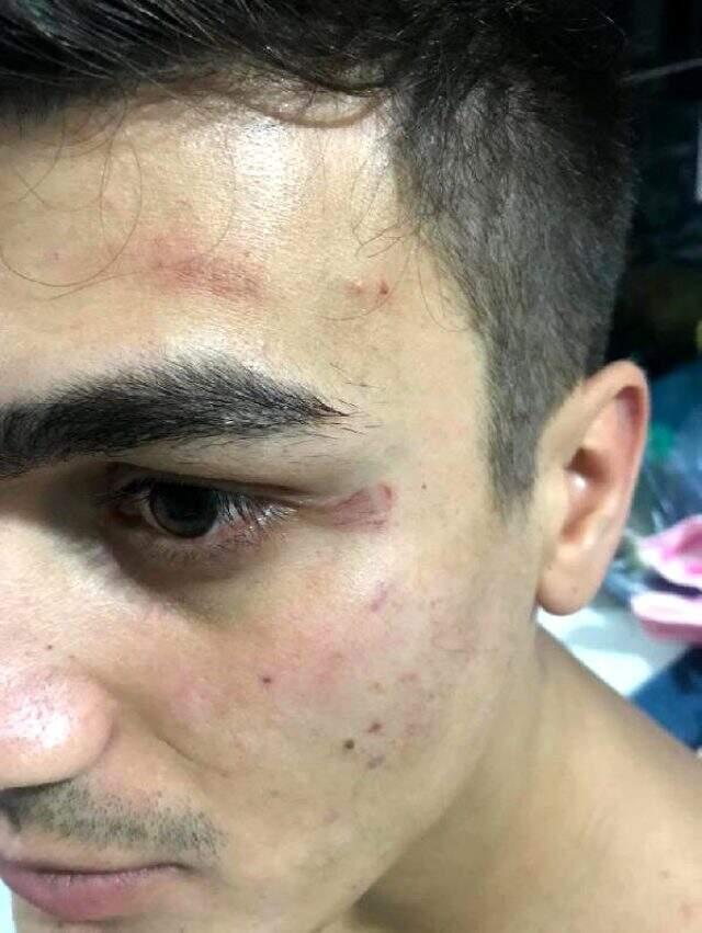 'Gürültü' şikayetine biber gazlı müdahaleye suç duyurusu