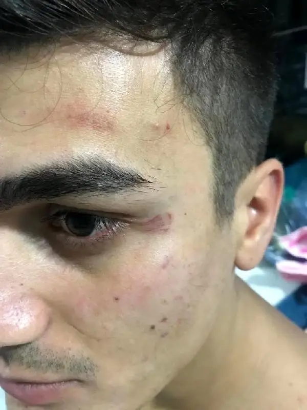 Evde yüksek sesle müzik dinleyen öğrencilere, darp ve biber gazlı müdahale Evde yüksek sesle müzik dinleyen öğrencilere, darp ve biber gazlı müdahale