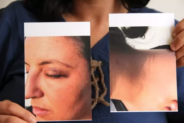 (Özel) Bir annenin feryadı: 'Emine Bulut gibi çocuklarımın önünde ölmek istemiyorum' (Özel) Bir annenin feryadı: 'Emine Bulut gibi çocuklarımın önünde ölmek istemiyorum'