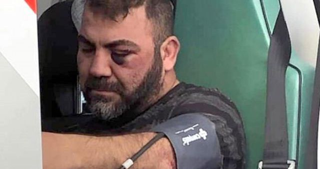 Alman polisi, Türk vatandaşını darp ettikten sonra sokağa bıraktı!