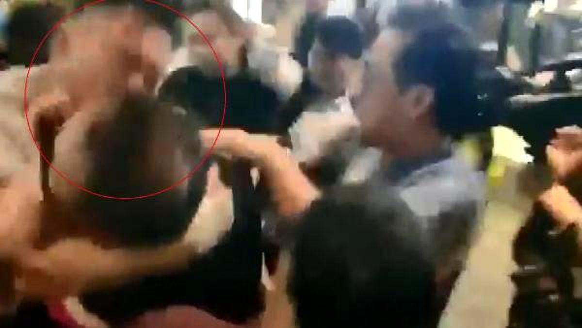 Hong Kong'da hükümet yanlısı bir kişi, protestocuları destekleyen meclis üyesinin kulağını bir AVM'de ısırarak kopardı