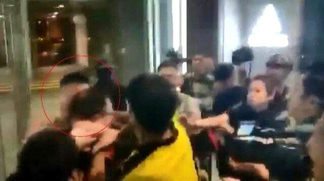 Hong kong'da hükümet yanlısı, meclis üyesinin kulağını ısırarak kopardı