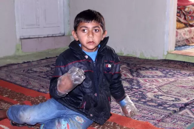 Minik Yusuf'un dramı: Sürekli ısırdığı ellerini plastik şişeye bağlıyorlar
