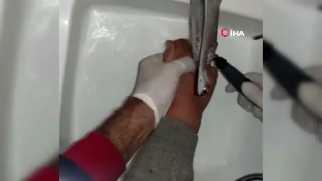 Parmağında sıkışan yüzüğü itfaiye çıkardı