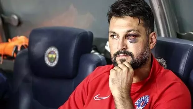 Ramazan Köse gözündeki morluğun nedenini açıkladı Ramazan Köse gözündeki morluğun nedenini açıkladı