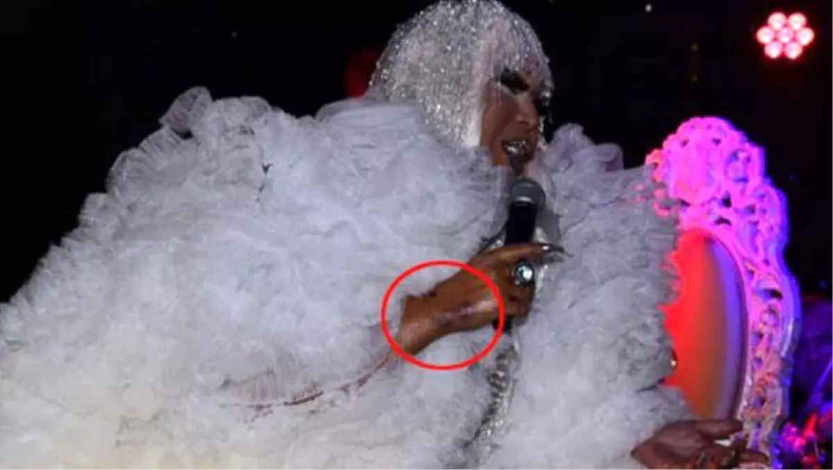 Bülent Ersoy'dan şok iddia: Ellerimi Seyhan Erdağ morarttı!