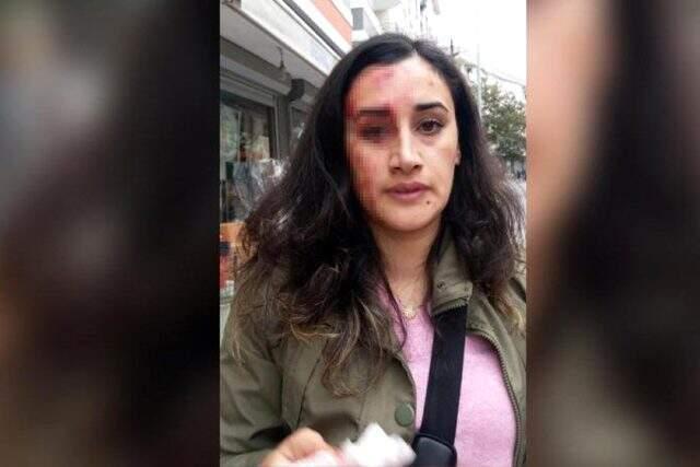 Tazminatını ödemeden işine son verdiği işçisinin başını yardı!