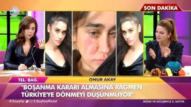 80 yaşındaki Amerikalı eşinden boşanma kararı alan Meltem Miraloğlu paylaşımıyla dikkat çekti