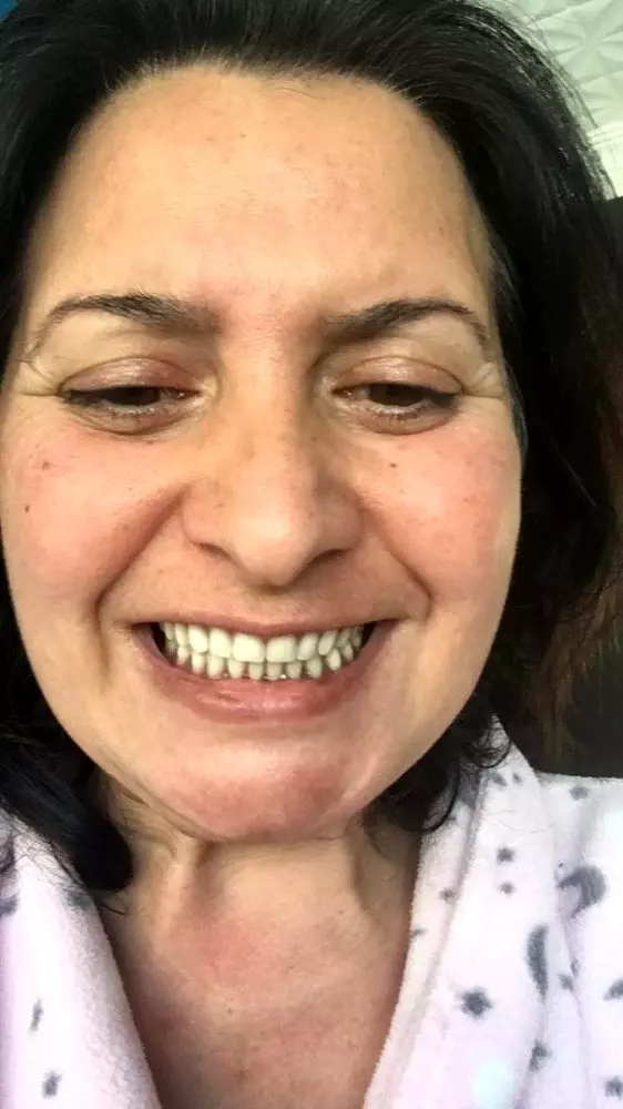 Beyaz diş hayaliyle 32 dişinden olmuştu! Bu kez de unutkanlıktan şikâyetçi Beyaz diş hayaliyle 32 dişinden olmuştu! Bu kez de unutkanlıktan şikâyetçi