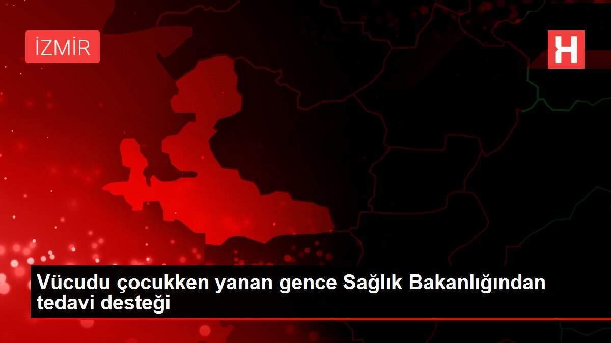 Vücudu çocukken yanan gence Sağlık Bakanlığından tedavi desteği