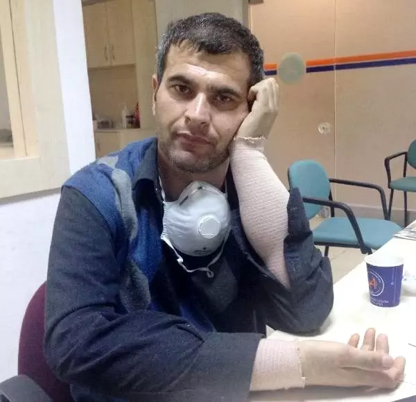 4'üncü çift kol nakli Antalya'da yapıldı (3) 4'üncü çift kol nakli Antalya'da yapıldı (3)