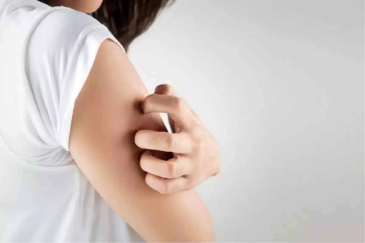 'Batı Nil Virüsü 20 farklı tür sivrisinekle bulaşabiliyor'