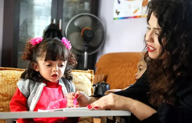 Kırılan elleri cam kemik hastası İlknur'a engel olmuyor Kırılan elleri cam kemik hastası İlknur'a engel olmuyor