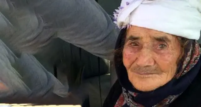 Sokak köpeği, yaşlı kadının yüzünü parçaladı! Hastanede yaşam savaşı veriyor