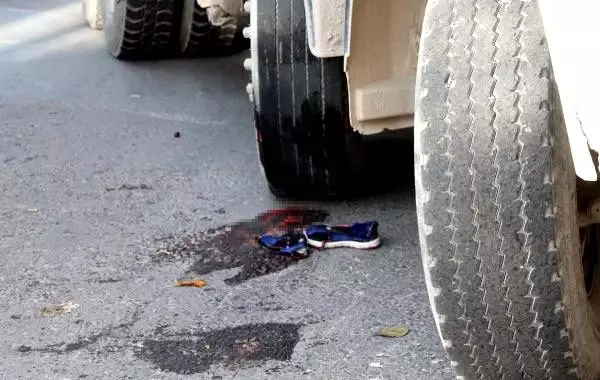 Ayakları kamyonun altında kalan Aylin'in sağ ayağı kesildi.