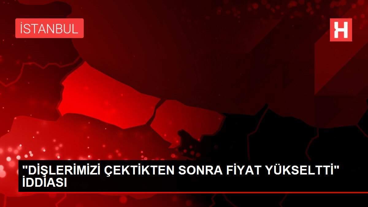 Zirkonyum Dis Kaplama Zirkonyum Kaplama Fiyatlari Anlik Fiyat Hesaplama