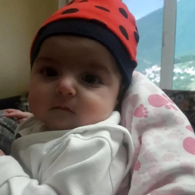Melis bebek yaşam mücadelesini kaybetti