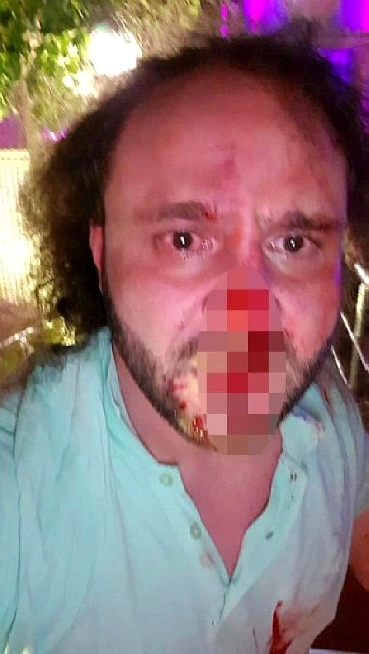 Yaşam koçunu darp eden 'bodyguard'lara hapis cezası
