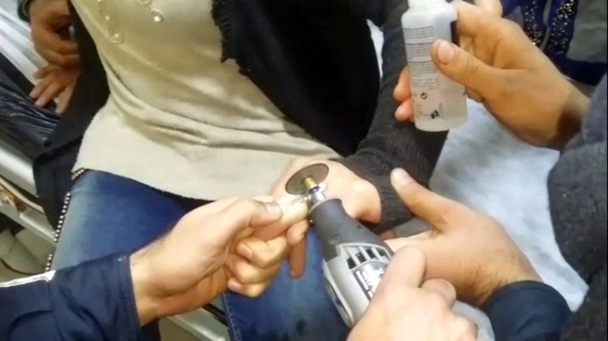 Genç kadının parmağına sıkışan yüzük kesilerek çıkarıldı Haberler