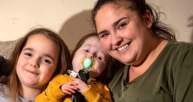 'Benjamin Button' hastalığı yüzünden yaşlı görünen 2 yaşındaki çocuğa babası 'babaanne' diyor