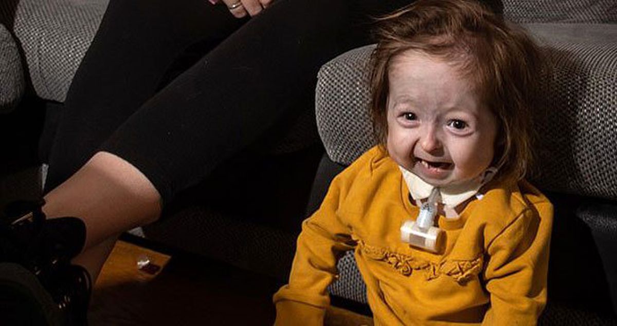 'Benjamin Button' hastalığı yüzünden yaşlı görünen 2 yaşındaki çocuğa babası 'babaanne' diyor