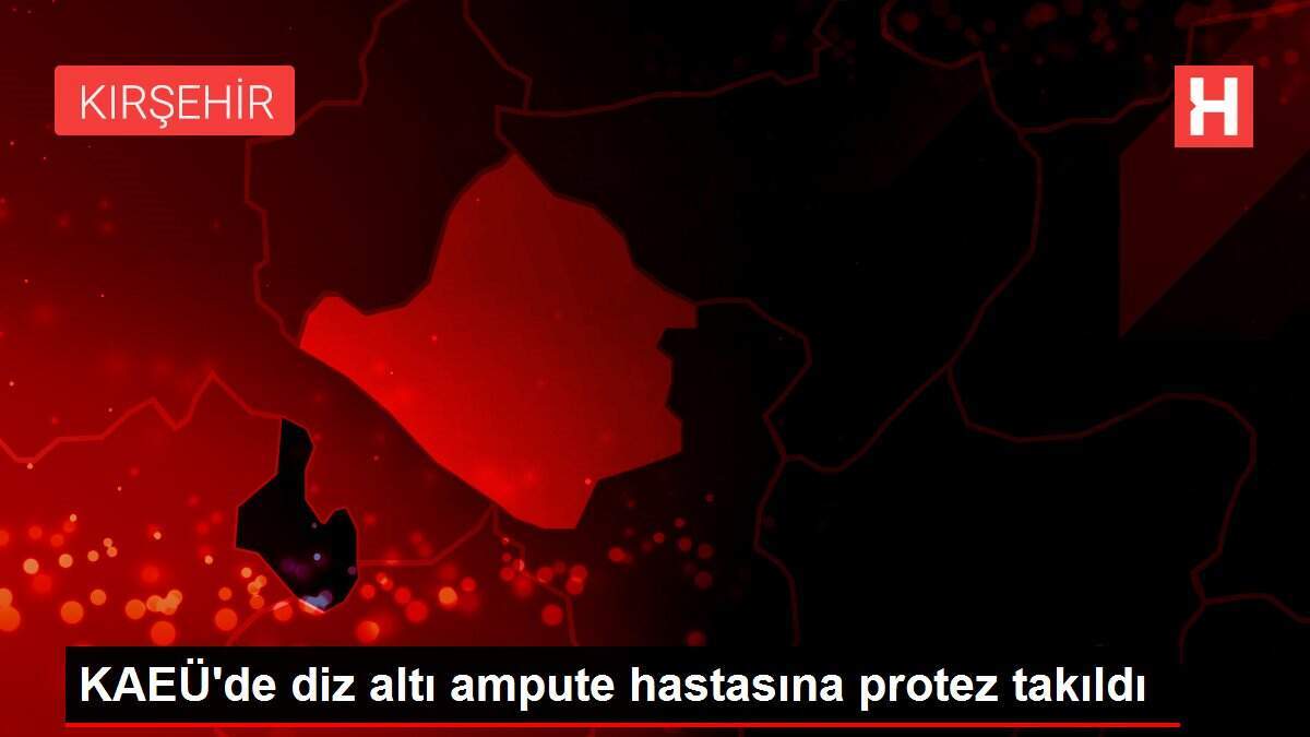 KAEÜ'de diz altı ampute hastasına protez takıldı