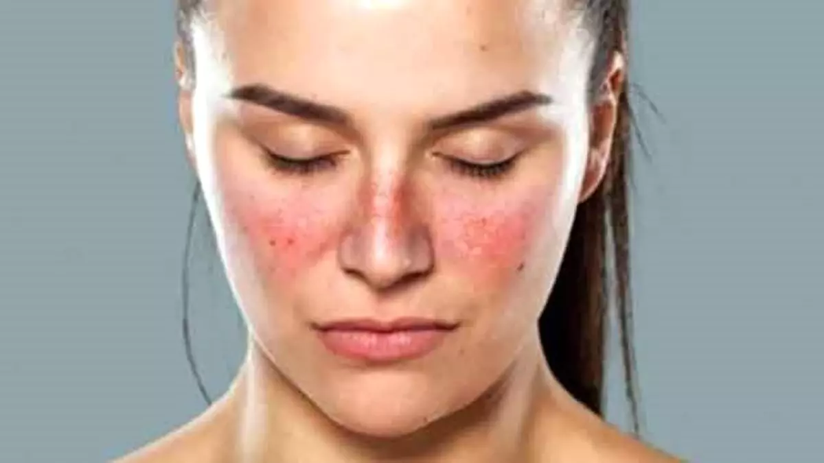 Bağışıklık sisteminin gardını düşüren hastalık