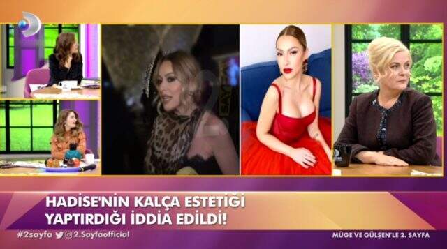 Hadise Kim Kardashian kalçasına sahip olmak için bıçak altına yattı