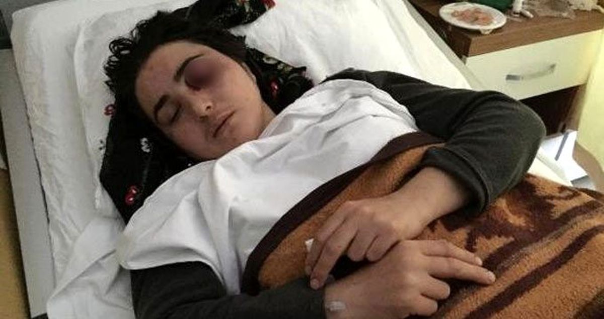 10 yıllık eşi tarafından öldüresiye dövülen Elif, yaşadığı korku dolu anları anlattı
