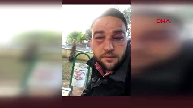 Babasini Ziyaret Etmek Istedi Yedigi Dayak Sonrasi Hafizasini Kaybetti Adana