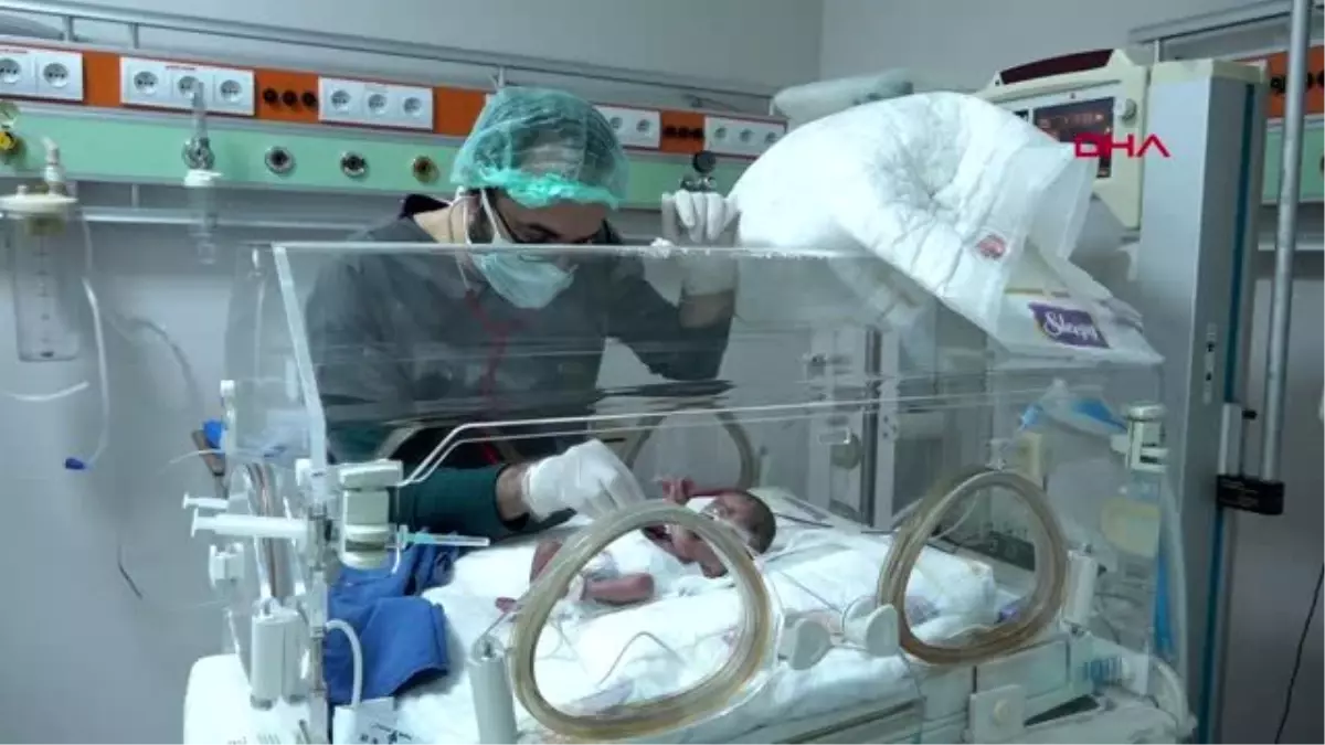 van 490 gram parmak bebek dunyaya geldi haberler