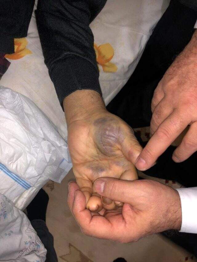 94 yaşındaki adamı bu hale getiren zanlı ya da zanlılar 4 bin lirasını gasp ettiler
