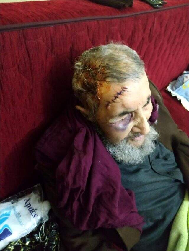 94 yaşındaki adamı bu hale getiren zanlı ya da zanlılar 4 bin lirasını gasp ettiler