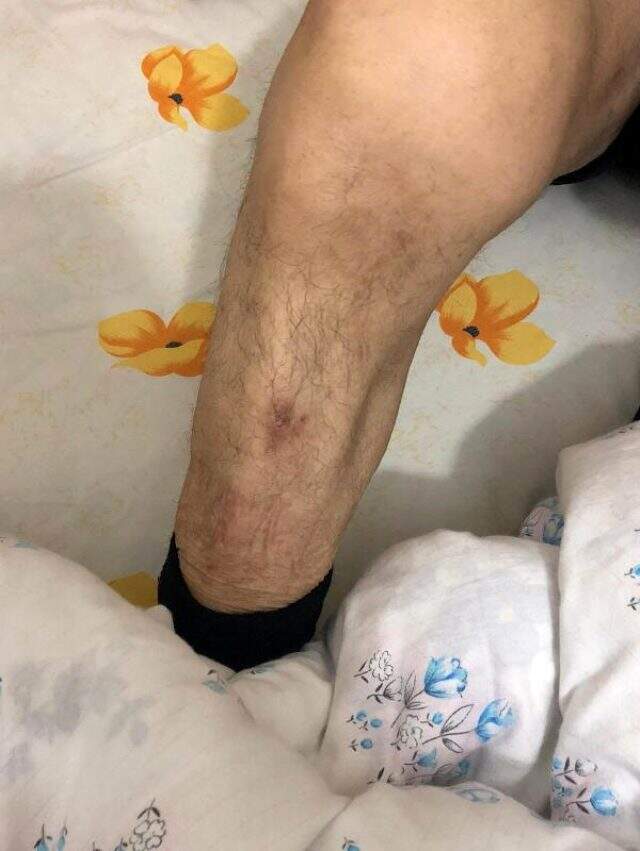 94 yaşındaki adamı bu hale getiren zanlı ya da zanlılar 4 bin lirasını gasp ettiler
