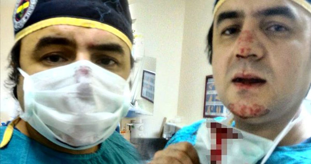 Doktor, burnunu kıran saldırganın eşine doğum yaptırdı